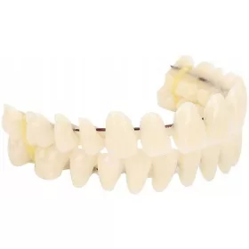  IMPLANTATE KÜNSTLICHE ZÄHNE KUNSTSTOFFPROTHESEZÄHNE