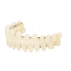  Kunstharzprothese für A2-Zähne