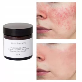 SAINT ÉTERNITÉ Beruhigende Salbe mit Ringelblumenextrakt