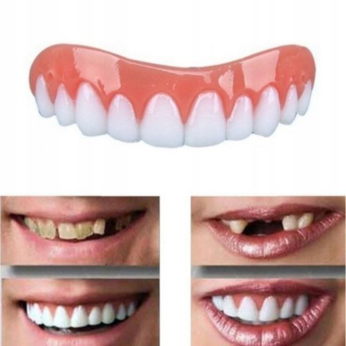  Obere und untere Veneers zum Erlernen des Lächelns