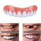  Obere und untere Veneers zum Erlernen des Lächelns