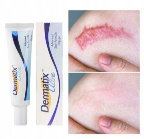 Dermatix Ultra - Innovativer Silikongel zur Narbenbehandlung und -prävention, 15g