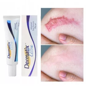   Dermatix Ultra - Hochwirksames Silikongel zur Narbenbehandlung und -prävention, 15g