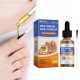 Bienen-Gift Nagelserum für die Behandlung von Nagelpilz, 50ml