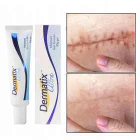   Dermatix Ultra Silikon-Gel für die effektive Narbenbehandlung, 15g Doppelpack