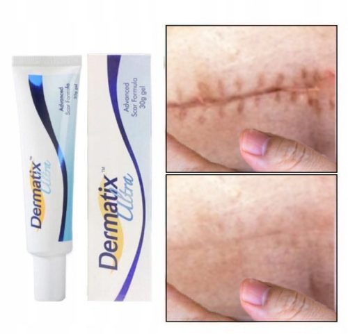 Dermatix Ultra Silikon-Gel für die effektive Narbenbehandlung, 15g Doppelpack